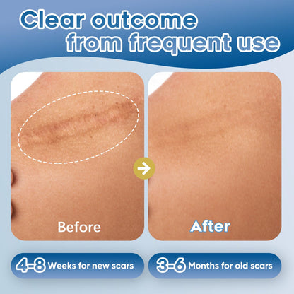 Glowor Advanced Silicone Scar Gel – Face & Body Scar Cream (3.53 oz)