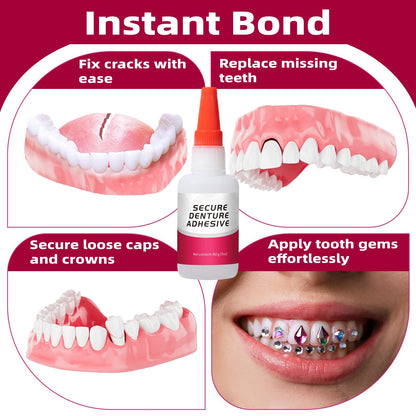 Dental Lab Instant Bonding Glue (1oz) for Denture Repair – Quick Bond, Lasts Days to Weeks