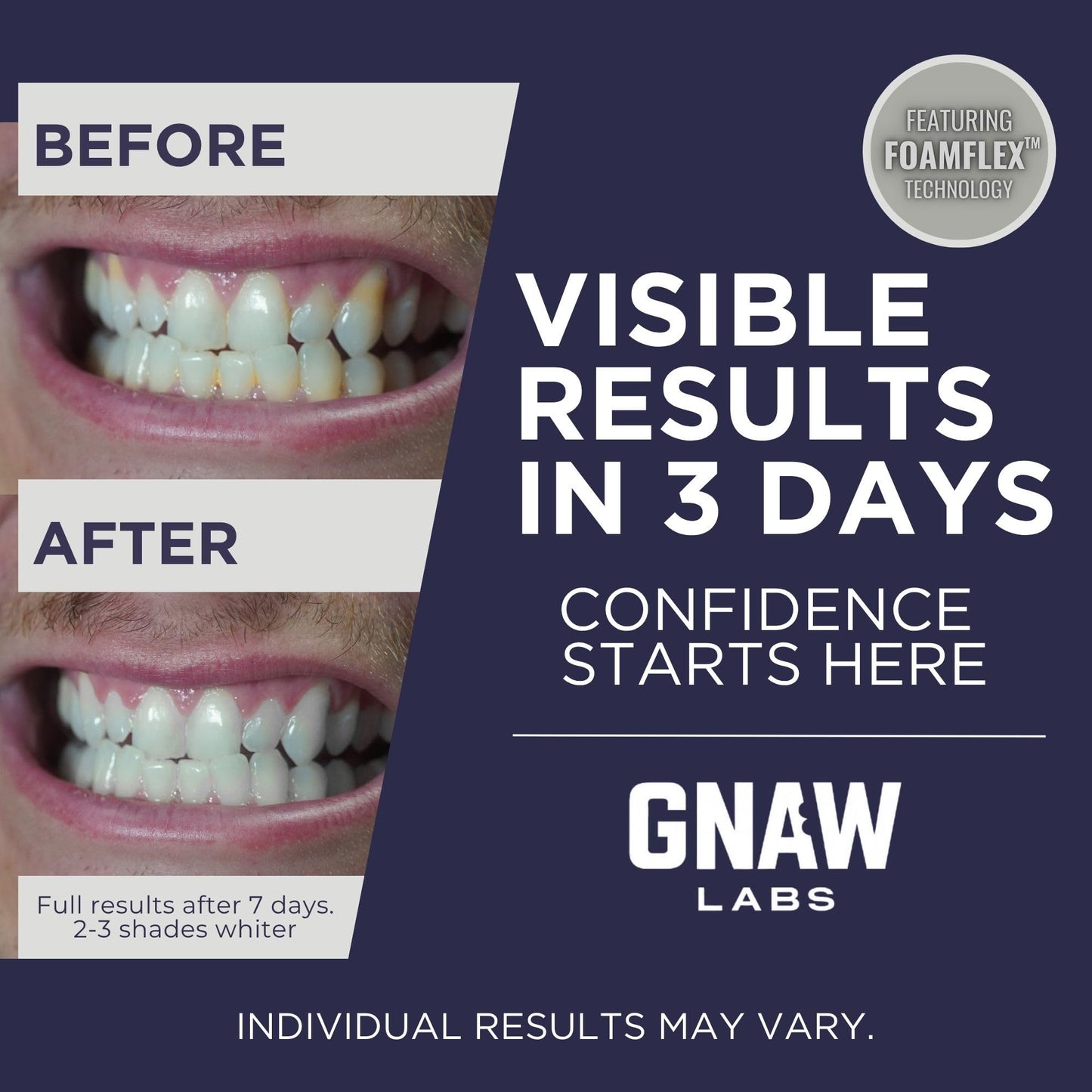 GNAW LABS Teeth Whitening Strips for Men – Mint Fresh, 14 Treatments | FoamFlex