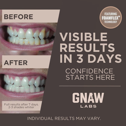 GNAW LABS Teeth Whitening Strips for Men – 14 Treatments