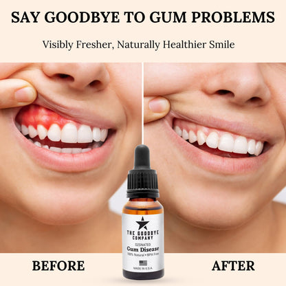 The Goodbye Company Ozonated Gum Treatment Oil – Clove & Neem for Healthy Gums | 15 ml