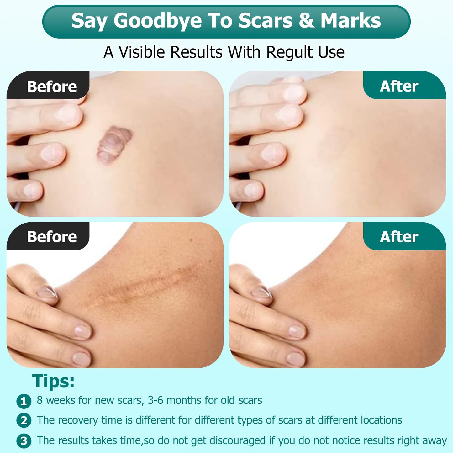Gowgaw Scar Gel – Advanced Silicone Scar Cream for Surgical & Skin Scars