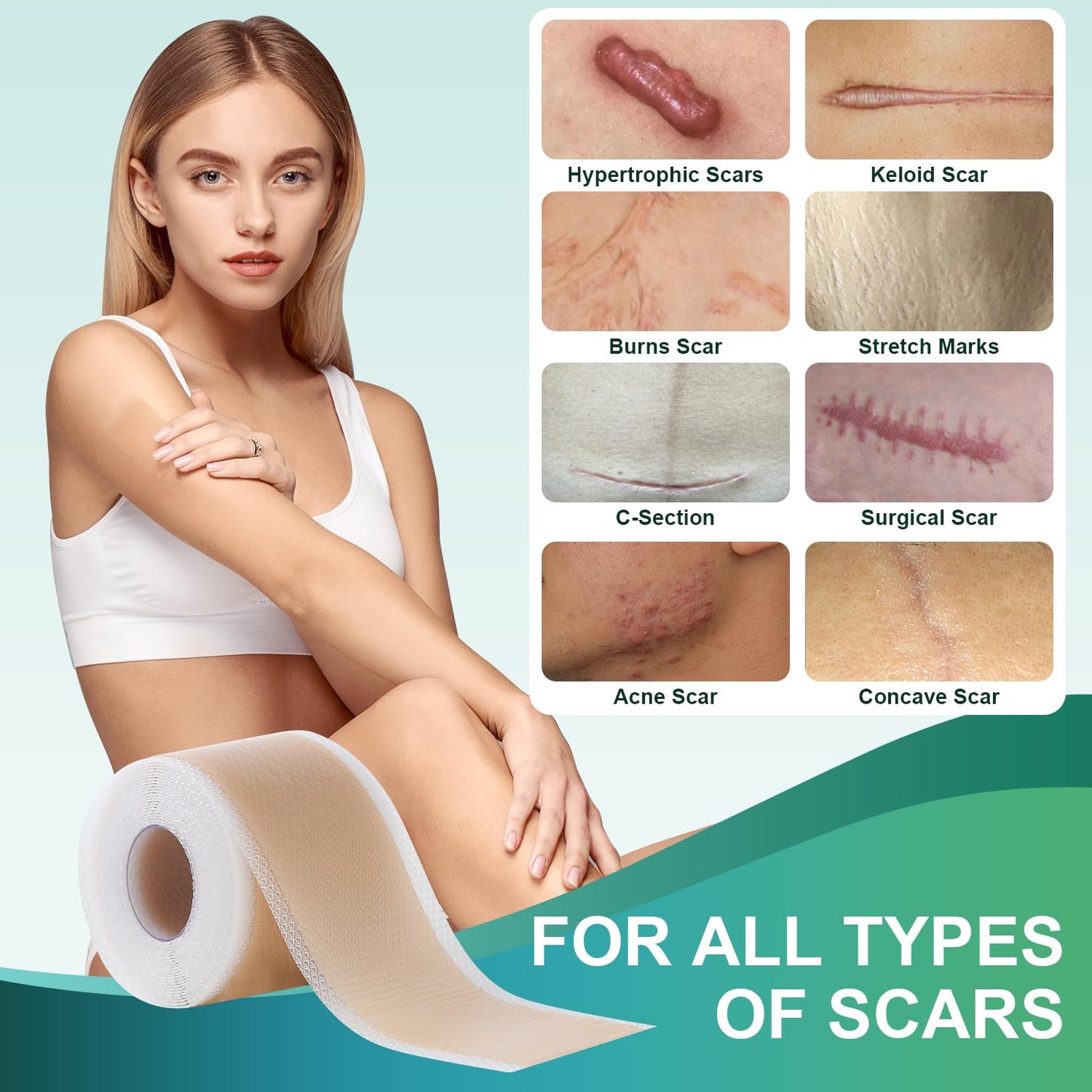 Gowgaw Medical Grade Silicone Scar Sheets | Reusable Scar Tape (1.6” x 60” / 1.5M) for Surgical, C-Section, Burns & Acne
