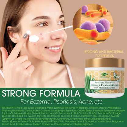 Green Leaf Naturals Manuka Honey Eczema Cream – Moisturizing Lotion for Dry Skin, Psoriasis Relief (16oz)