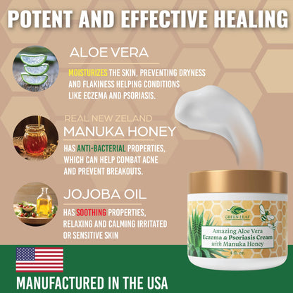 Green Leaf Naturals Manuka Honey Eczema Cream — Fragrance-Free Moisturizer (8oz)