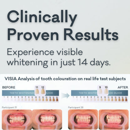 Grin Pro Enzyme Whitening Toothpaste | Nano-Hydroxyapatite, Fluoride Free, SLS Free, Peppermint – 4 oz