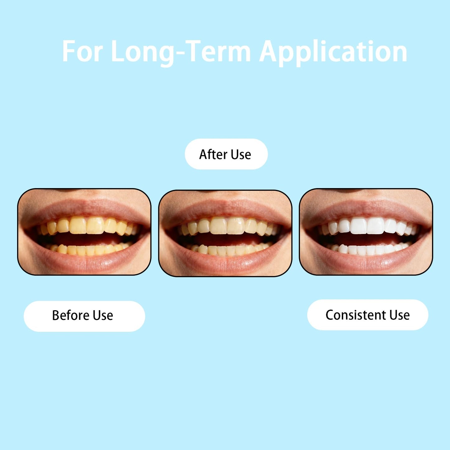 Cavity Healing Tooth Armor Liquid – Transparent Enamel Strengthening with Hydroxyapatite