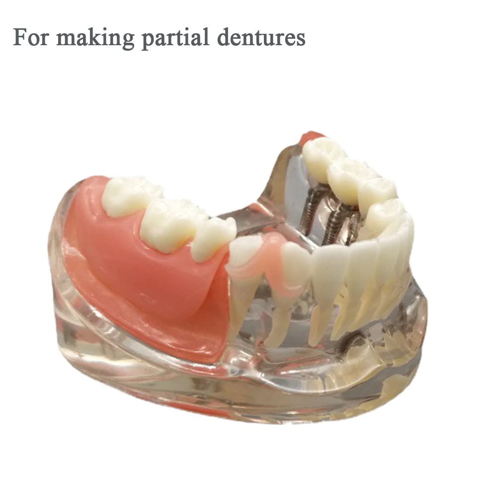 Gum Material for DIY Dentures - Teeth Fitting & Denture Repair Kit
