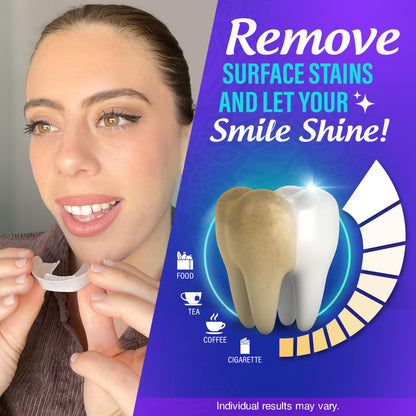 GuruNanda Ready-to-Use Prefilled Whitening Trays – 7 Treatments, 8% Hydrogen Peroxide