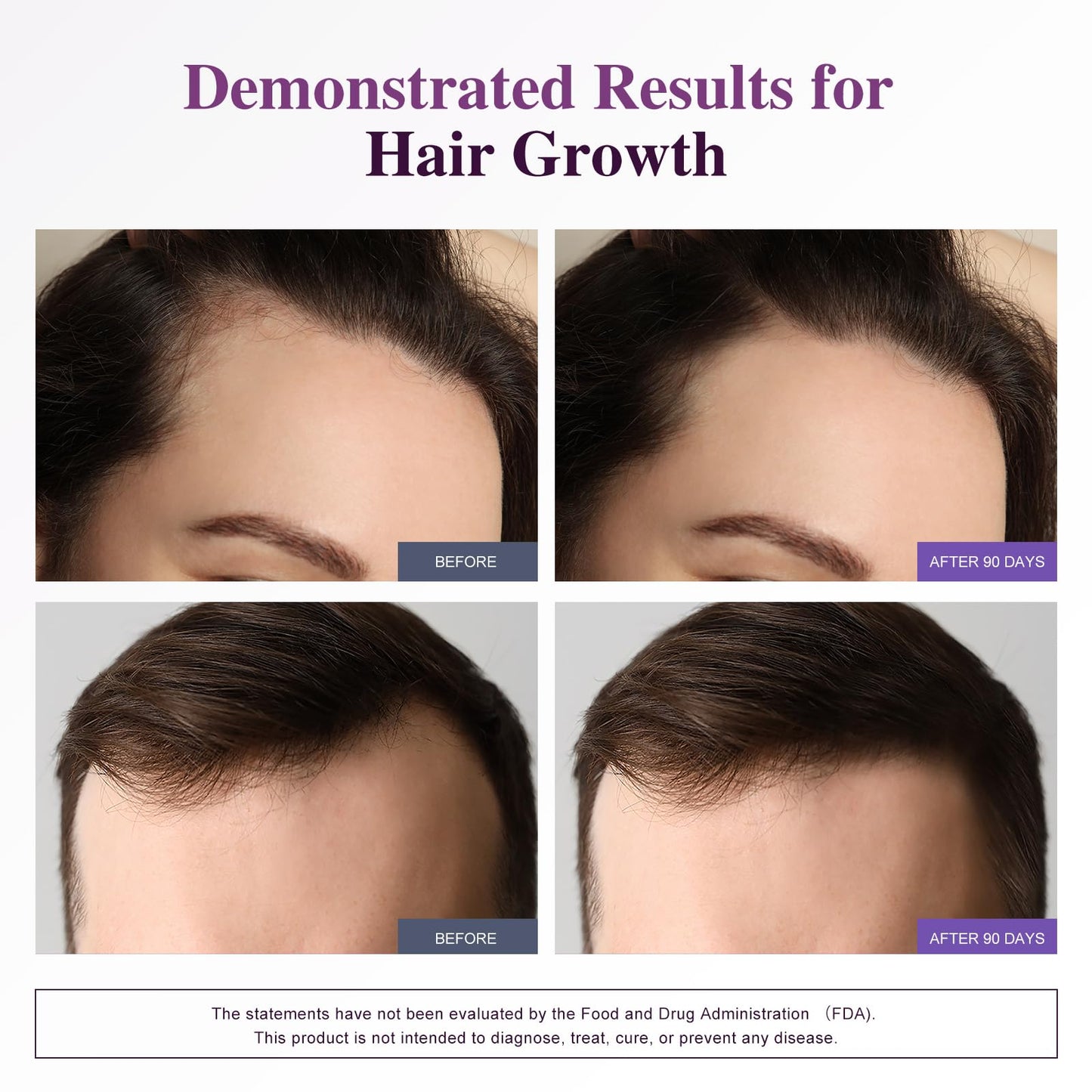 Biotin 10,000MCG Hair Growth Support – Collagen & Keratin – Hair Skin Nails Vitamins – 120 Capsules (2-Month Supply)