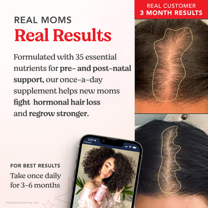 HAIRtamin MOM – Vegan Prenatal & Postnatal Hair Vitamins for Pregnancy & Breastfeeding
