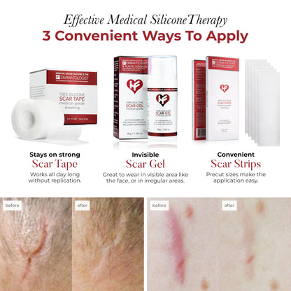 HealFast Physician Formulated Silicone Scar Sheets – Medical-Grade Tape for Surgery, C-Section & Keloids