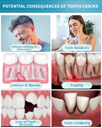 Healing Teeth Crack Toothpaste - Enamel Repair & Remineralizing 100g