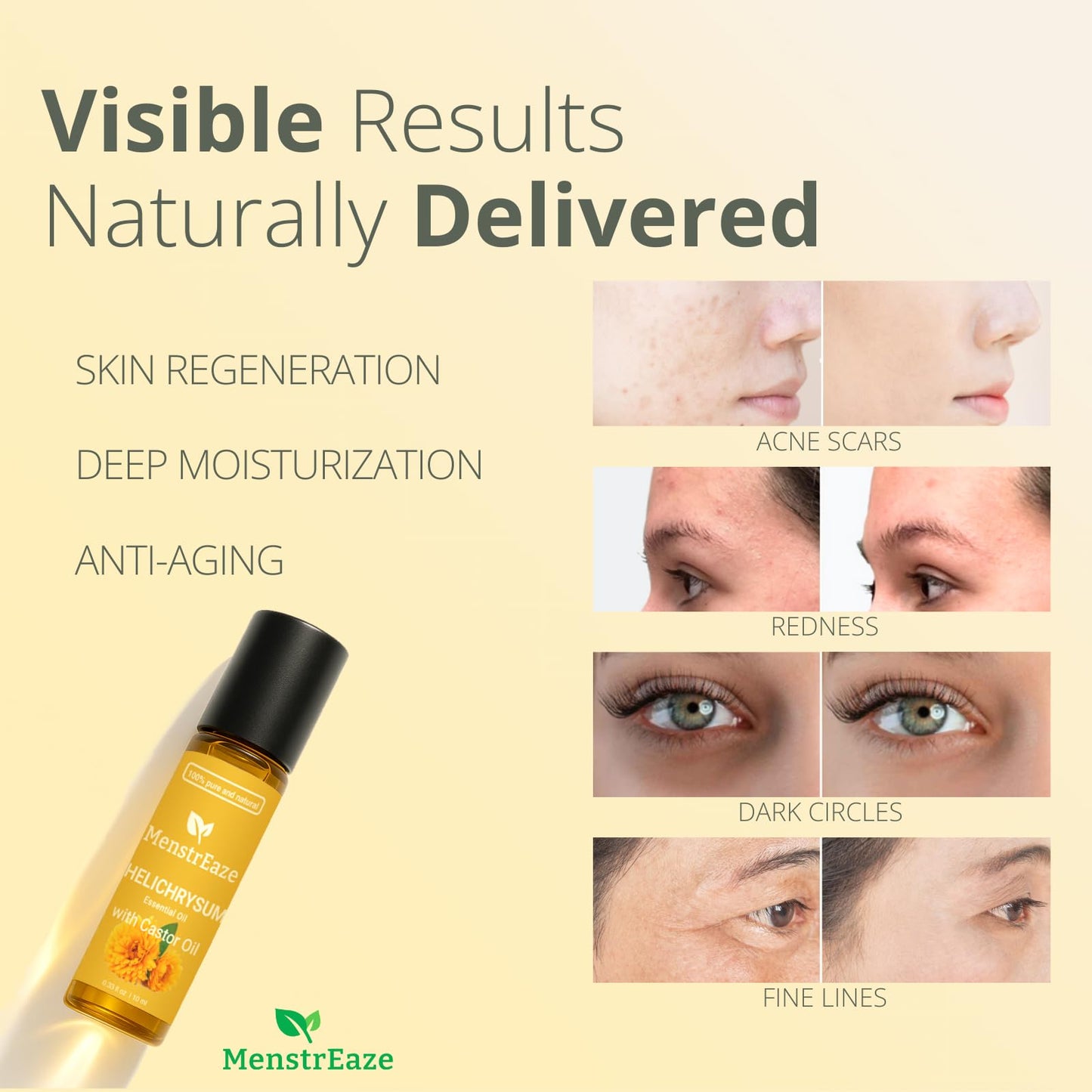Helichrysum & Castor Oil Roll-On 10ml | High Potency, Acne & Anti-Aging