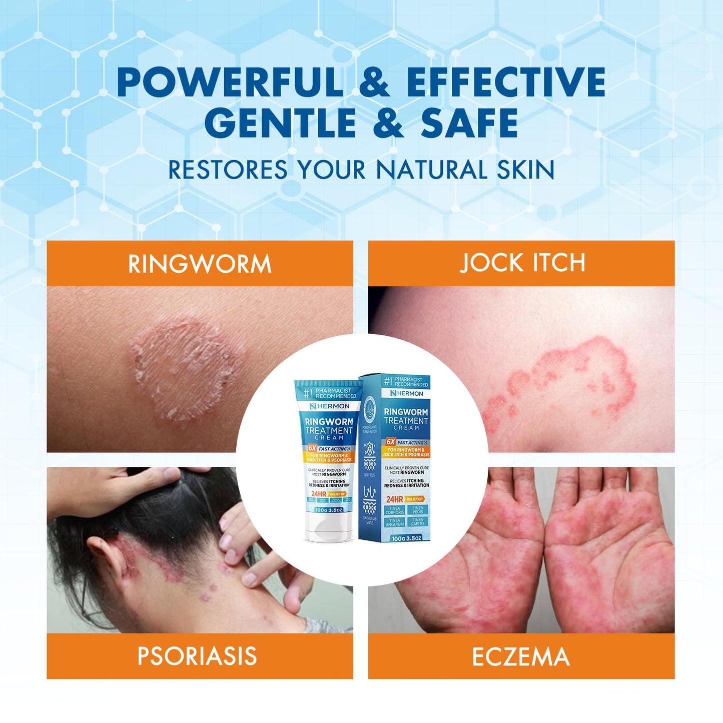 Hermon Powerful Antifungal Ringworm Cream - Fast Relief for Ringworm, Jock Itch & More (100ml)