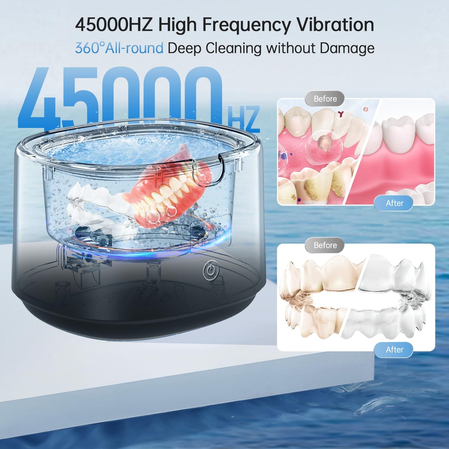 High-Frequency Vibration Retainer Cleaner – 30W/45kHz, 230ml Portable