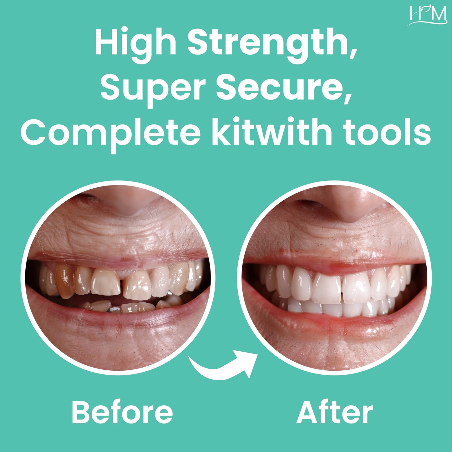 HM Zinc Oxide Eugenol Dental Cement Kit | DIY Self-Curing Tooth Repair & Emergency Care