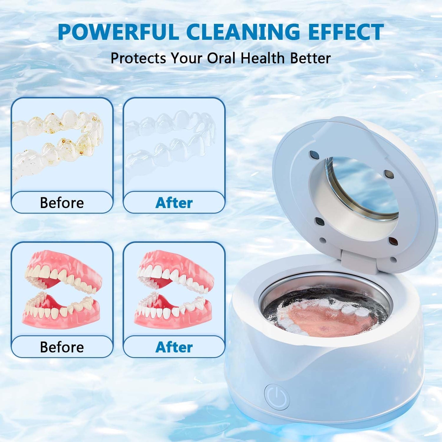 Hoffeins Ultrasonic Retainer Cleaner – 45kHz, 200ml, Portable