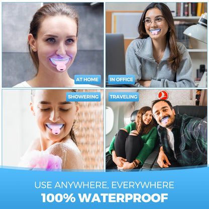 Teeth Whitening Kit for Sensitive Teeth - 16 LED Light, 30 Min - Pink