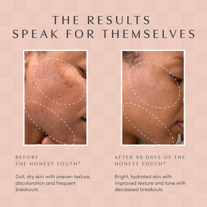Apothékary The Honest Youth: Collagen & Skin Support Drops