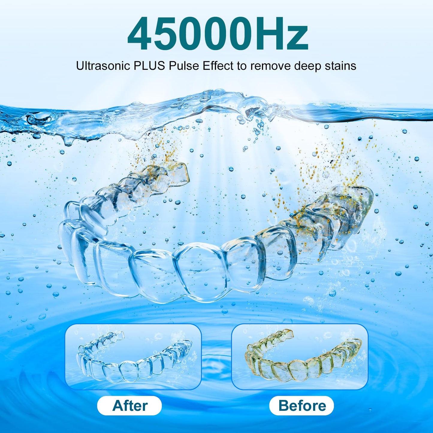 Hossili Ultrasonic Retainer Cleaner Machine – 200ML, 45kHz, 4 Modes, Digital Timer