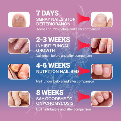 HULEIWA Toenail Fungus Treatment Extra Strength + Nail Repair Kit (2PCS)