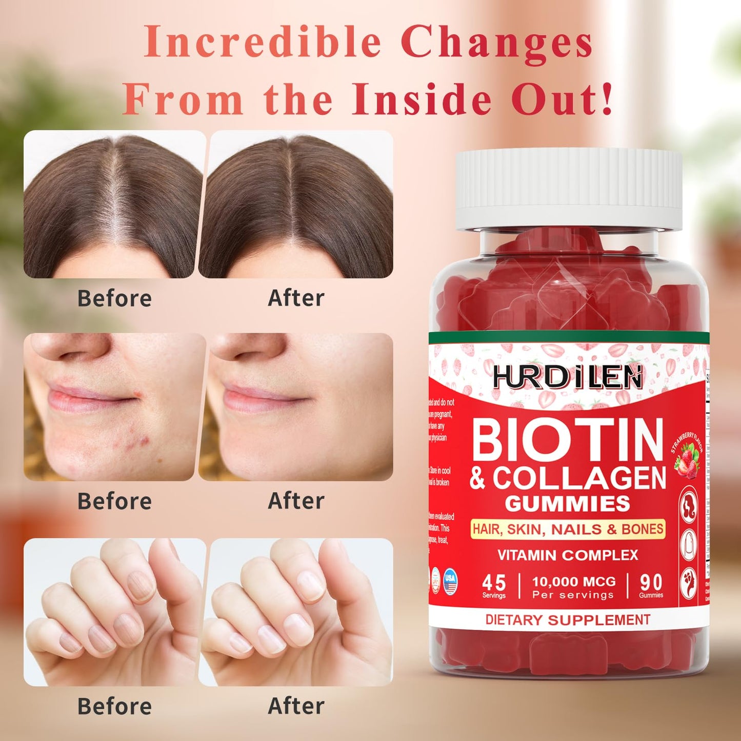 Hurdilen Biotin Collagen Gummies – 10,000 mcg Biotin for Hair, Skin & Nails | 90 Gummies