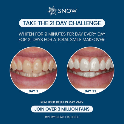 Snow Teeth Whitening Kit - LED Mouthpiece, Hydroxyapatite, 3 Wands