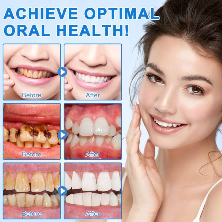 Hydroxyapatite Toothpaste – Enamel Repair & Cavity Prevention, Fluoride-Free, Fresh Mint 1 Pack