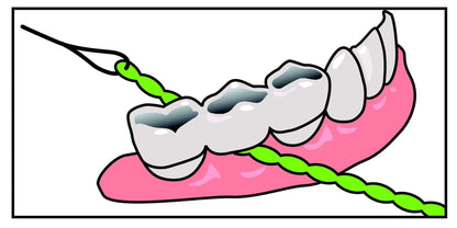 IDontix Brace X-Floss Green - Implants, Bridges & Braces