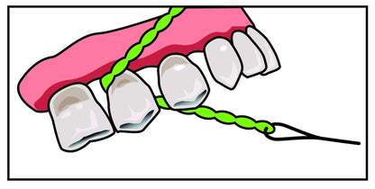 IDontix Brace X-Floss Green - Implants, Bridges & Braces