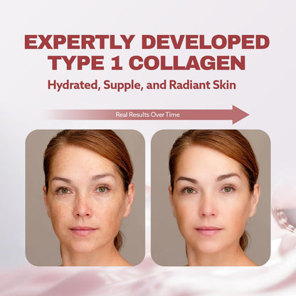 ILO Liquid Collagen Drink – 3,000mg Type 1 Marine Collagen with Biotin & Milk Ceramide | Skin Glow & Hydration | Orange Flavor | 8 Bottles