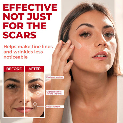 MYHELP Medical Grade Silicone Scar Sheets – Transparent 6pk (7in x 1.6in) for C-Section Scars