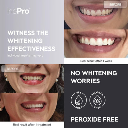 InoPro Natural Teeth Whitening Strips Kit – 14 Treatments for Sensitive Teeth (28 Strips) – Peroxide-Free