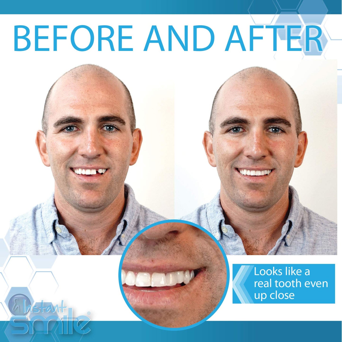 Complete Your Smile Deluxe Tooth Replacement Kit with Beads