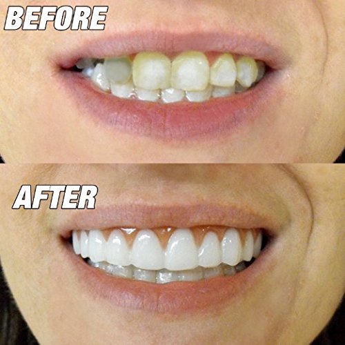 Instant Smile Comfort Fit - Slightly Imperfect, Natural White, One Size