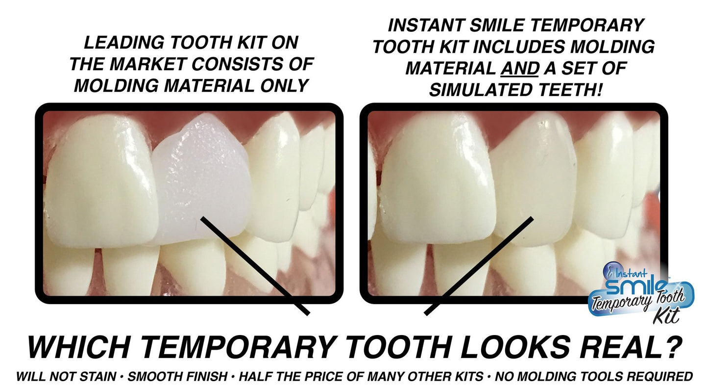Instant Smile MULTISHADE Patented Temporary Tooth Repair Kit | Realistic Missing or Broken Tooth Solution
