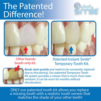Instant Smile Pro Series Temporary Tooth Kit – At-Home Replacement