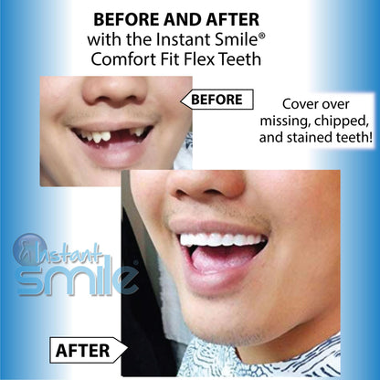 Instant Smile Flex Teeth (Bright White) & Pro Series Tooth Kit – 2 Instant Smile Products