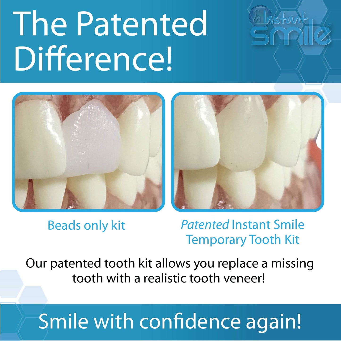 Instant Smile Temporary Tooth Replacement Kit - Replace a Missing Tooth Fast (Patented)