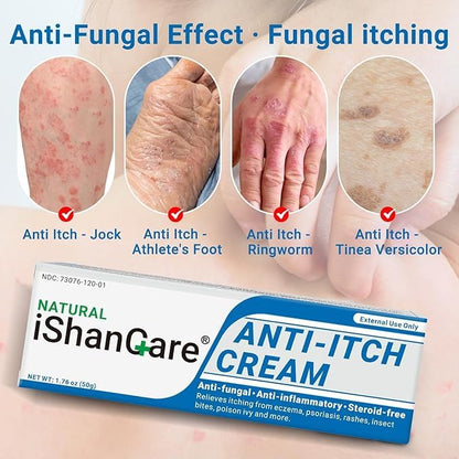 ishancare Anti Itch Soothing Cream Extra Strength — Full-Body Itch Relief Ointment (1.76 oz)