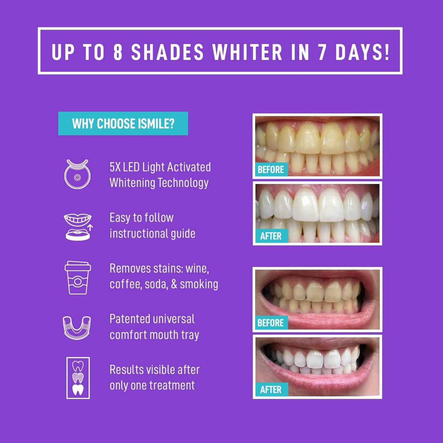 iSmile Teeth Whitening Kit — LED Light, 35% Carbamide Peroxide, 3x 3ml Gel, Remineralization Gel & Tray