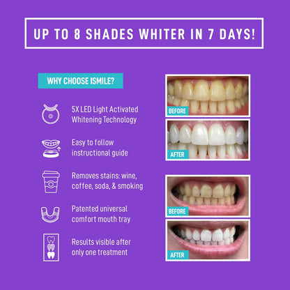 iSmile Teeth Whitening Kit — LED Light, 35% Carbamide Peroxide, 3x 3ml Gel, Remineralization Gel & Tray