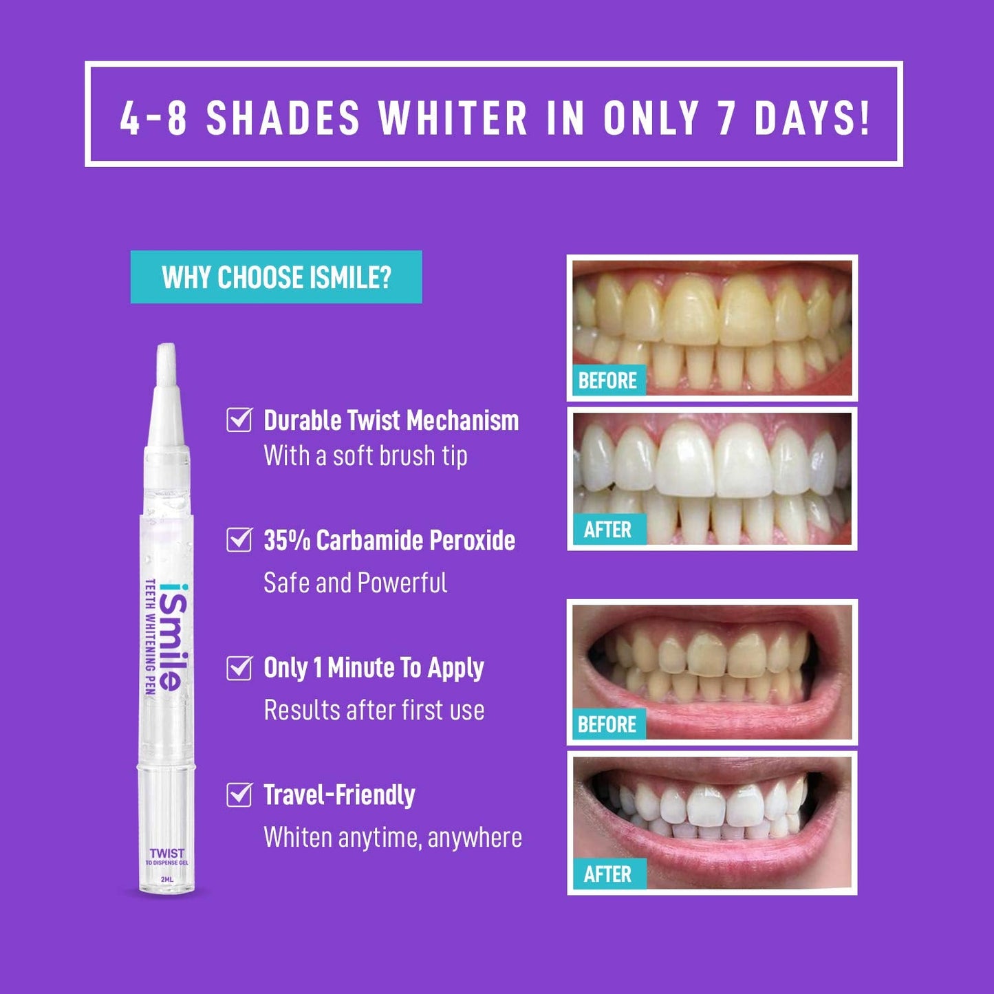 iSmile Teeth Whitening Pen - 35% Carbamide Peroxide, No Sensitivity, Travel-Friendly, 2mL, 2 Pack