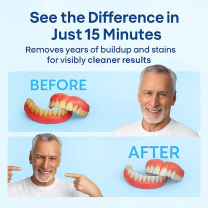 iSonic F3900 Ultrasonic Denture & Retainer Cleaner – 42 kHz, 200 ml Tank