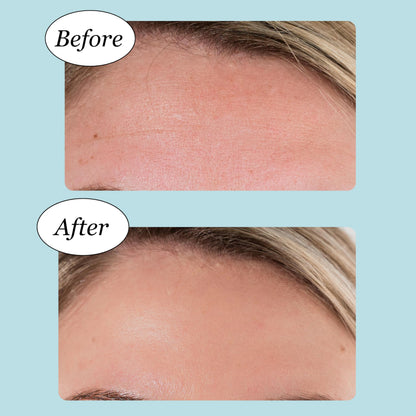 JANE VINE Forehead Wrinkle Patches – Anti Wrinkle, Cooling Collagen Hydration (20 Pcs)