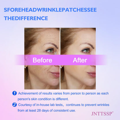 JNTTSSP Smile Line & Forehead Wrinkle Patches - Anti-Wrinkle, 36 Packs