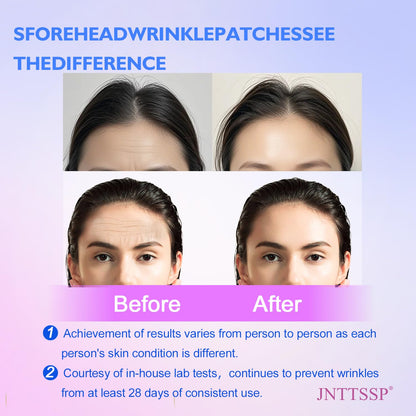 JNTTSSP Forehead Wrinkle Patches - Collagen & Vitamin E Patches (12 Packs)