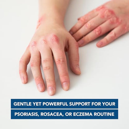 Kenkoderm Psoriasis Cream — 2% Salicylic Acid, Fragrance-Free Moisturizer (10 oz)