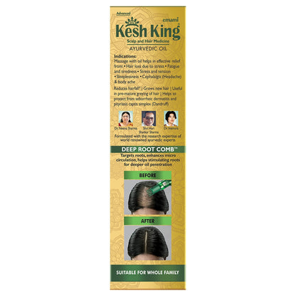 Kesh King Ayurvedic Hair Oil - 300ml | 21-Herb Formula for Hair Growth & Reduced Hairfall
